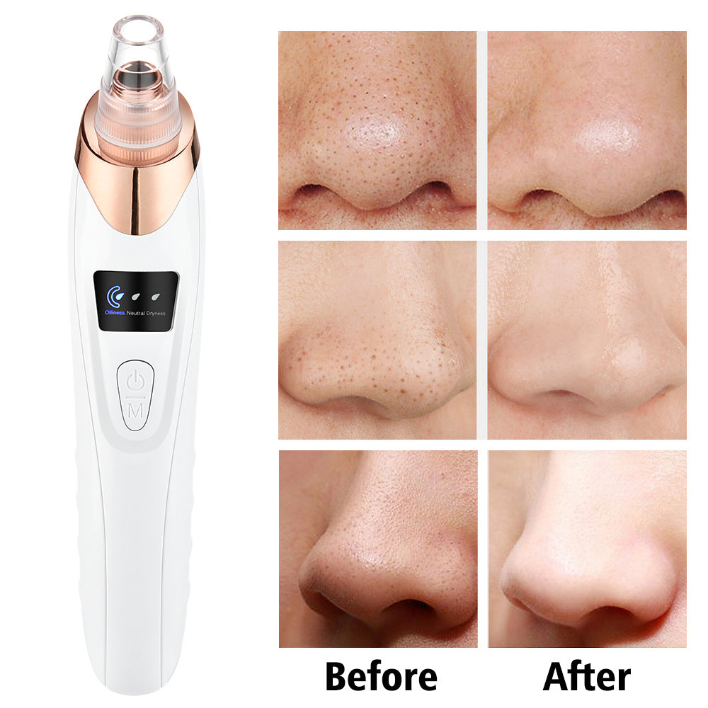 Blackhead Suction Instrument Electric Vacuum Blackhead Acne Remover Facial Beauty Acne Pore Cleaner